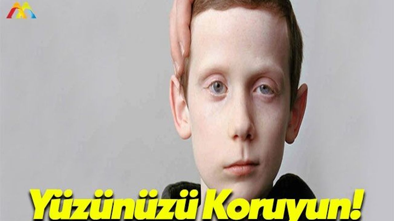 Nöroloji Uzmanı Prof. Dr. Zülküf Önal: Yüz Felcine Neden Oluyor!