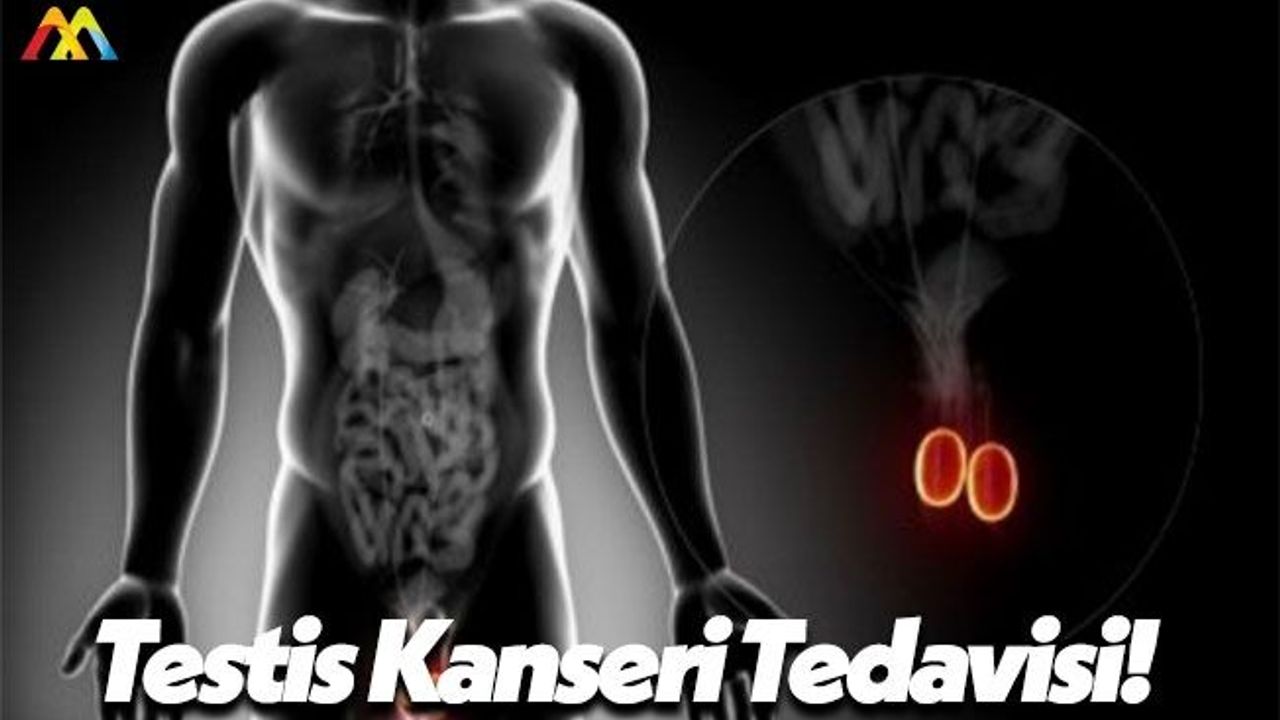 Testis Kanseri Kimlerde Olur ve Kimlerde Daha Çok Görülür?