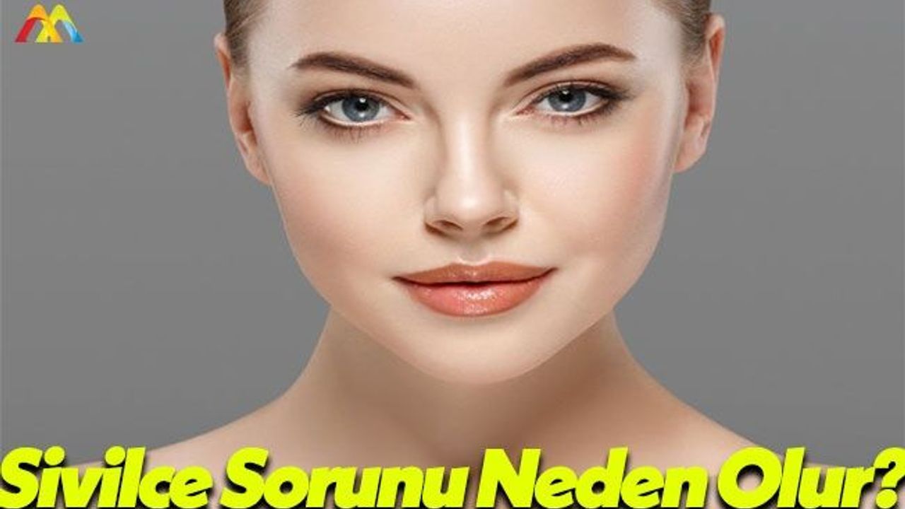 Uzmanlardan Sivilce Sorunu İle İlgili Açıklama!