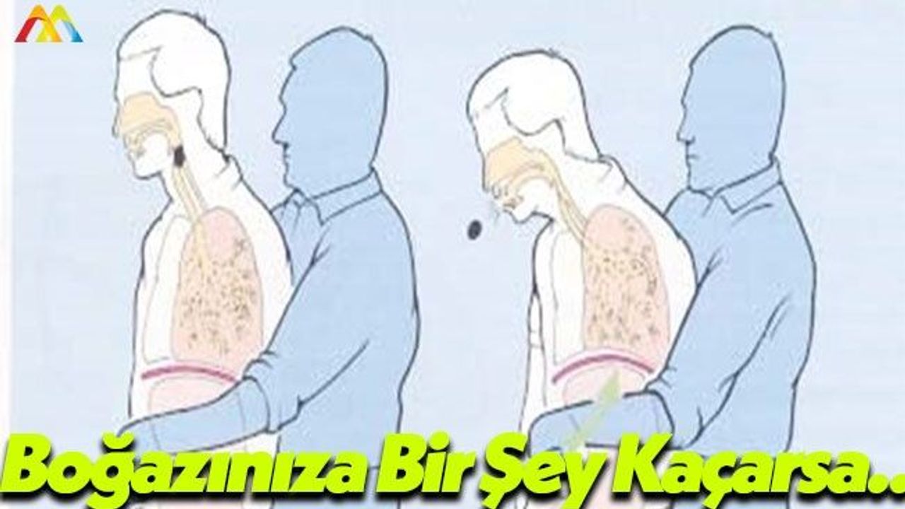 Bebeklerin Boğazına Bir Şey Takılır İse...