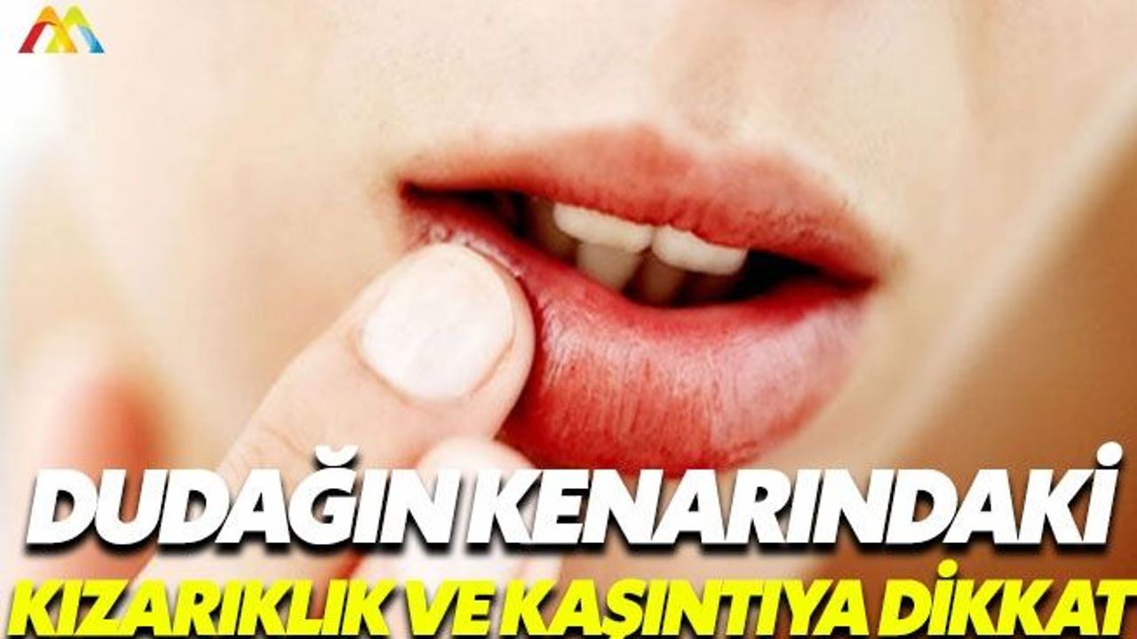 Dil ve dudakta şişme besin alerjisinin belirtisi