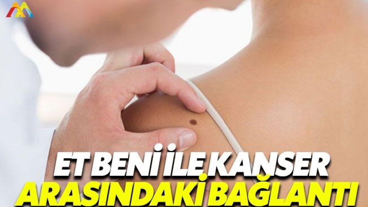 Solaryum ve güneş cilt kanserlerini tetikliyor