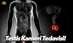 Testis Kanseri Kimlerde Olur ve Kimlerde Daha Çok Görülür?